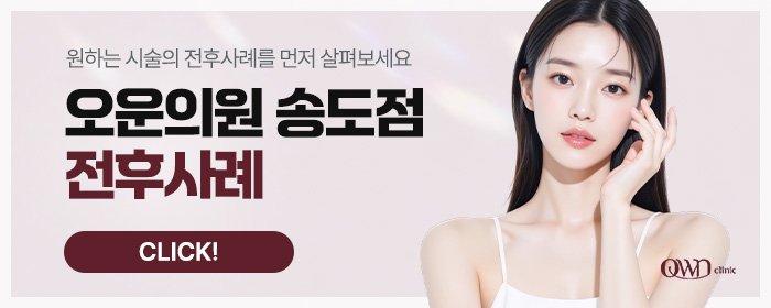 송도풀페이스필러